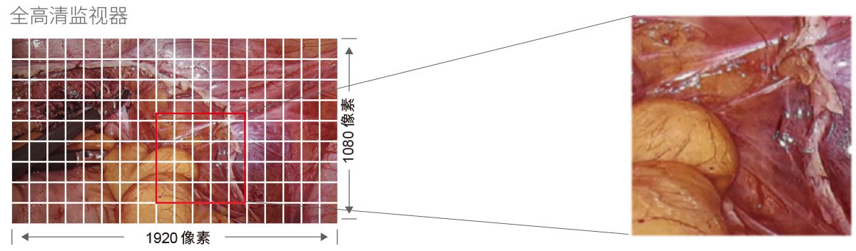 32英寸醫(yī)療手術(shù)室專(zhuān)用監(jiān)視器