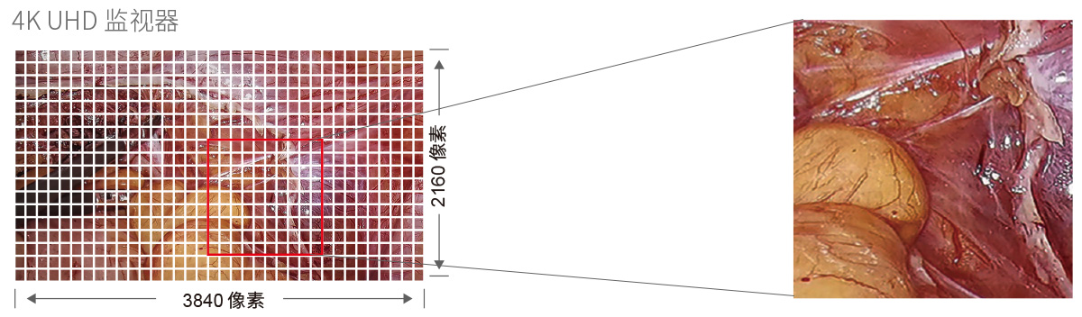32英寸醫(yī)療手術(shù)室專(zhuān)用監(jiān)視器