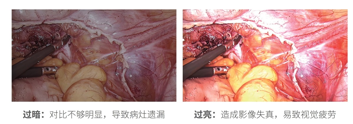 32英寸醫(yī)用監(jiān)視器